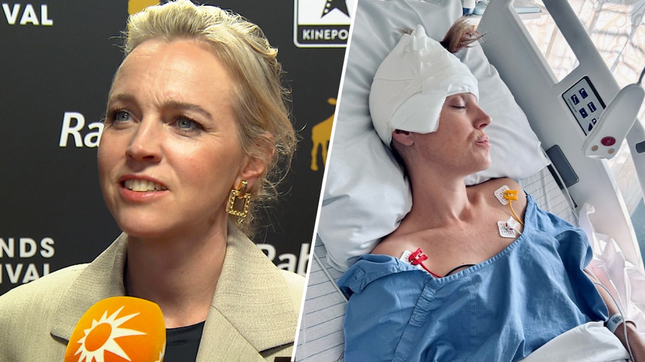 Loes Haverkort deelt details over wakkere hersenoperatie: 'Heel bizar'