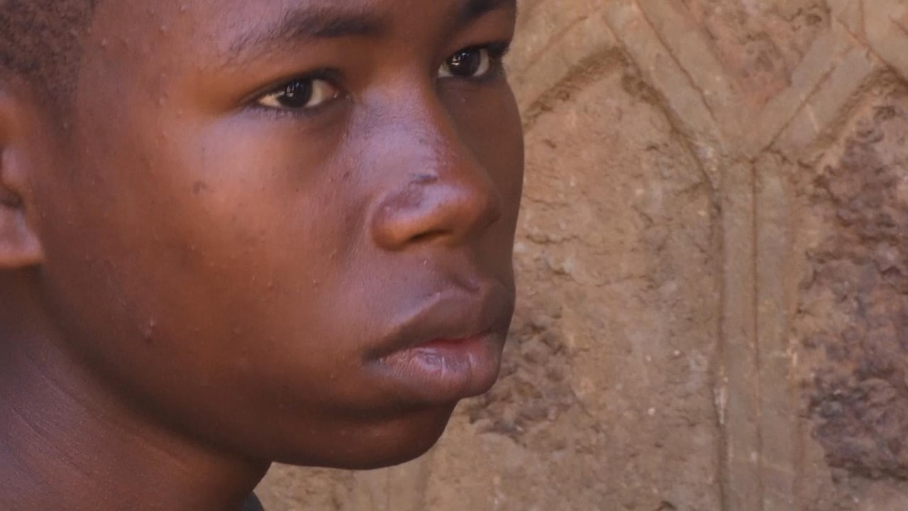 Bekijk ook: Usama wist te ontsnappen aan Boko Haram en vertelt zijn verhaal.