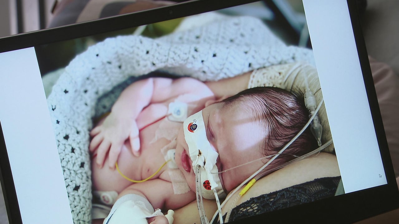 Bekijk ook: Maria's baby lag drie weken op de ic door RS-virus