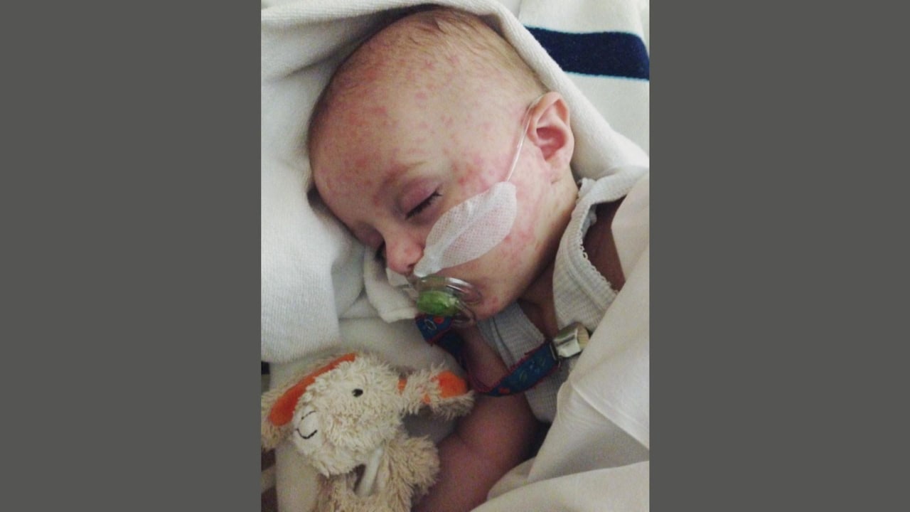 Baby Micha had de mazelen en kreeg uiteindelijk een hartinfectie