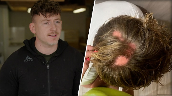 Joey ging door diep dal na oplichting door Wesley: 'Haaruitval van de stress'