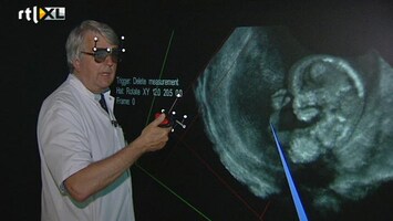 RTL Nieuws Nieuwe 3D-techniek voor echo's bij baby's