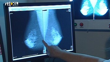 RTL Z Nieuws 30.000 Franse vrouwen moeten borstimplantaten later verwijderen