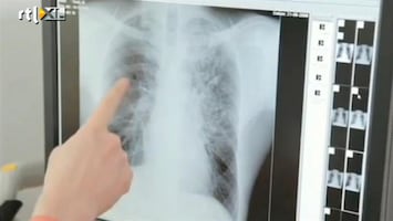 RTL Nieuws Hoop op een nieuw medicijn tegen TBC
