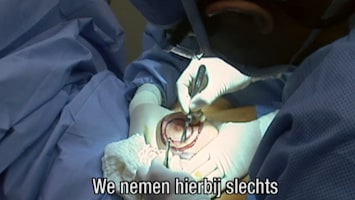 Het Verhaal Achter Plastische Chirurgie - Afl. 8