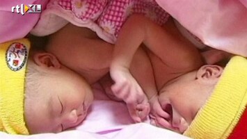 RTL Nieuws Chinese artsen gaan siamese tweeling scheiden