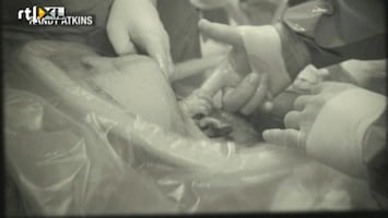 RTL Z Nieuws Baby pakt hand dokter al bij keizersnede
