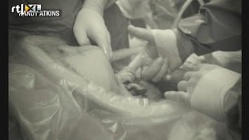 Editie NL Gaaf: ongeboren kind grijpt hand arts