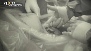Editie NL Ongeboren baby geeft handje aan dokter
