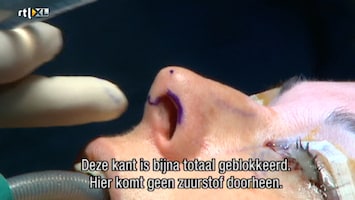 Het Verhaal Achter Plastische Chirurgie Het Verhaal Achter Plastische Chirurgie /10