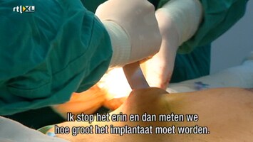 Het Verhaal Achter Plastische Chirurgie Het Verhaal Achter Plastische Chirurgie /6