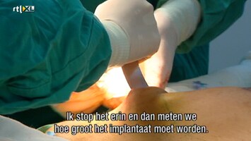 Het Verhaal Achter Plastische Chirurgie Het Verhaal Achter Plastische Chirurgie /6