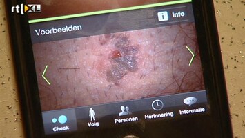 Editie NL App herkent huidkanker