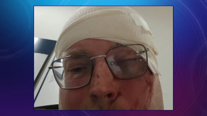 Verwarde man slaat Theo bont en blauw met steelpan