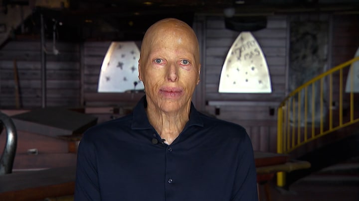 Getroffenen Volendambrand doen hun verhaal: 'Je leven weer oppakken' 