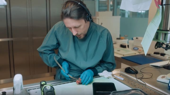 Microscoop kan zien waar tumor zit: 'Is precisiewerk'