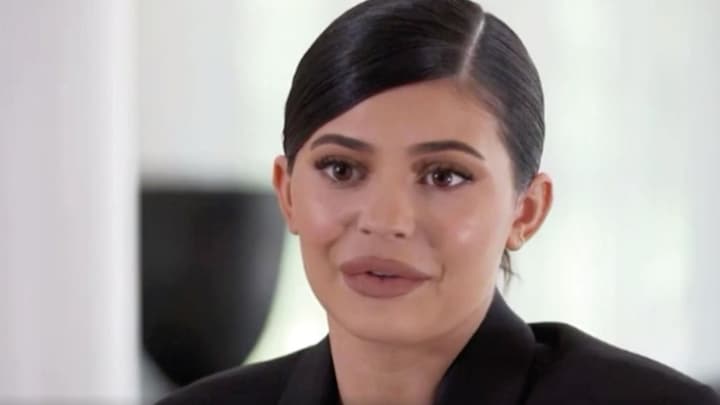 Om dit jeugdtrauma besloot Kylie Jenner lipfillers te gebruiken