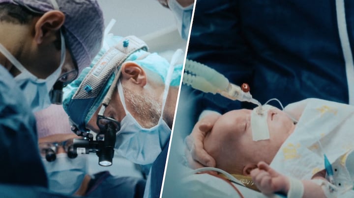 Kinderchirurgen opereren wekenoude baby Huub aan tumor in Het Kinderziekenhuis