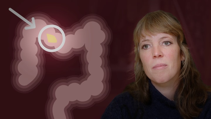 Darmkanker is allang geen ouderdomsziekte meer: dit is het verhaal van Paulien (39)