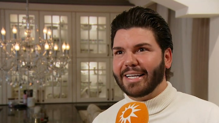 Roy Donders doet boekje open over fiasco cosmetische kliniek