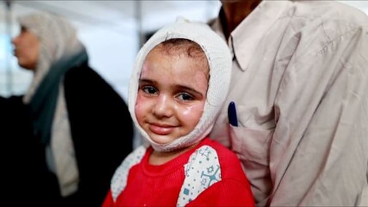 Gewond en getraumatiseerd: Hanin (5) mag Gaza uit, maar ze is een van de weinigen