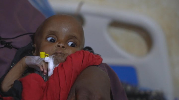 Terwijl wereld naar Oekraïne kijkt, voltrekt zich ramp in Somalië: miljoen kinderen ondervoed