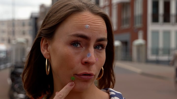 Kom je met deze vrolijke stickers af van je puistjes? Gen Z gelooft er heilig in