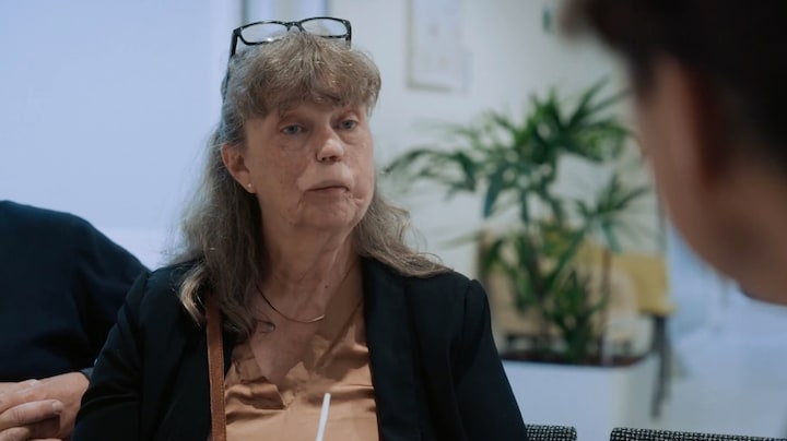 Ingrid kreeg deel van geamputeerde gezicht terug met huid uit onderarm: 'Is toch ongelofelijk'