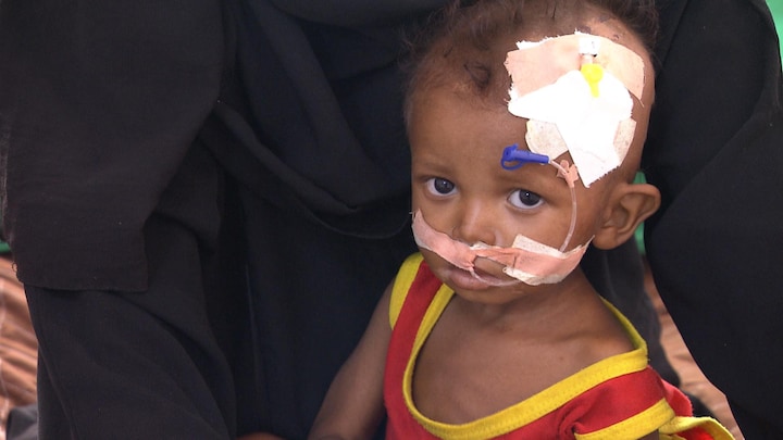 Artsen in Jemen zijn wanhopig: 'Steeds meer zieke baby’s en kinderen'