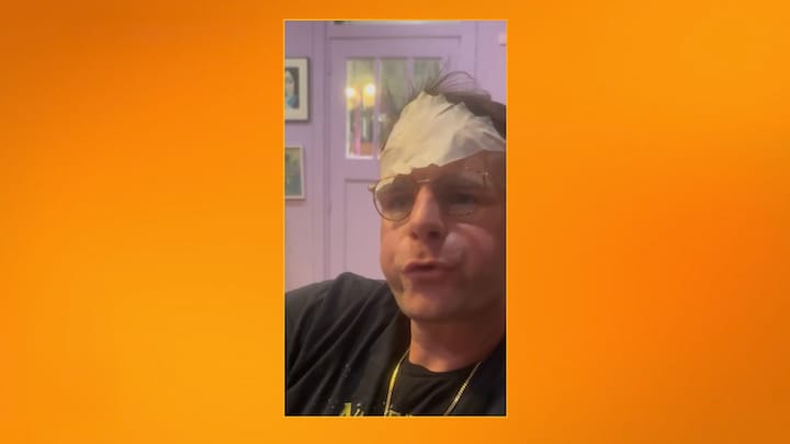 Henry van Loon brengt hilarische Kim-parodie uit B&B Vol Liefde