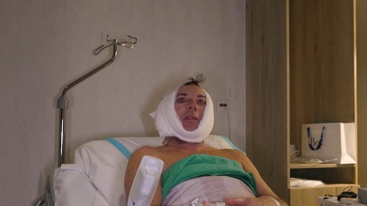 Eerste beelden van Gerard Joling verschenen na gezichtsoperatie