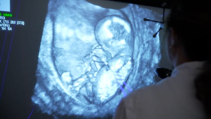 Uniek: met deze hologram-echo kunnen ouders hun foetus beter bekijken