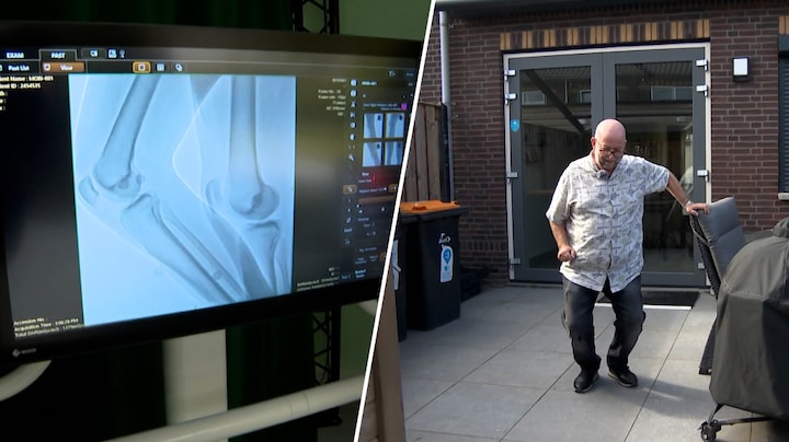 Onderzoek naar toekomst zonder kunstknie voor artrosepatiënten