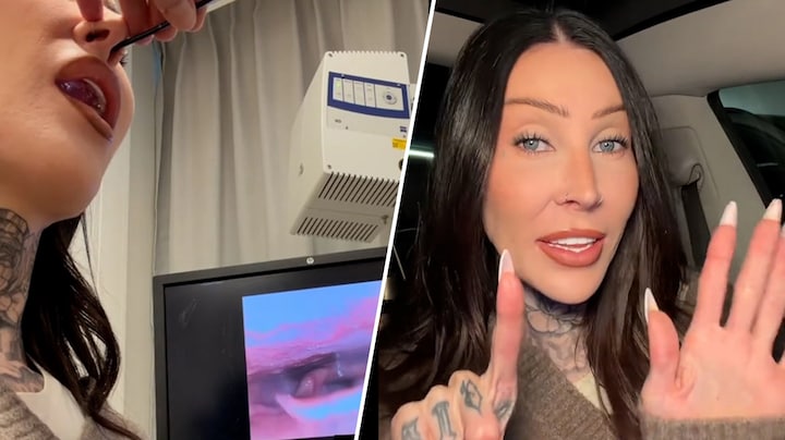 Jessie Maya geeft update na operatie aan stembanden